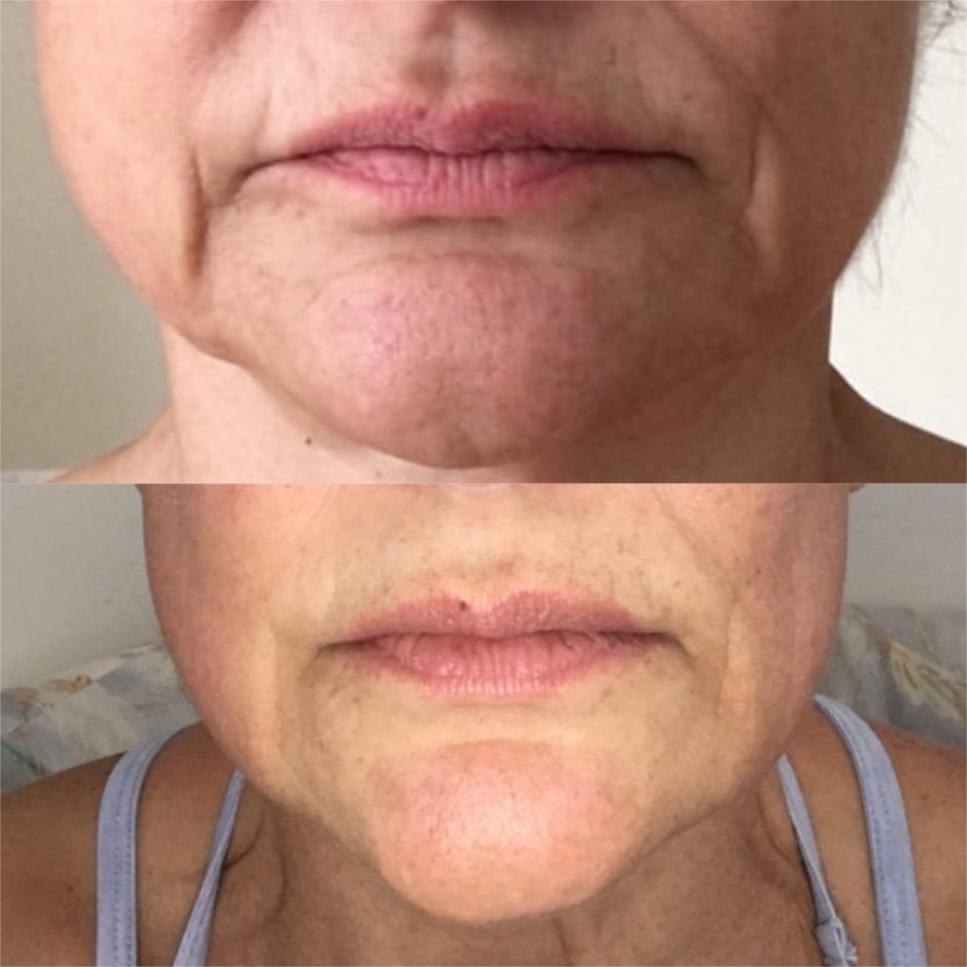 CCC31126-39D8-4CD1-9A56-EEE43F392285_1_105_c