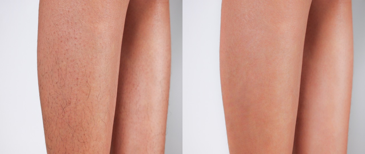 Radiant Skin House - Finchley, North Finchley