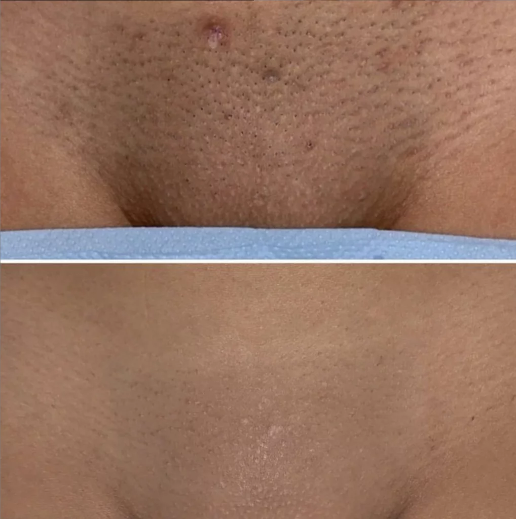 Screenshot-2021-05-07-at-14.44.28-1018x1024