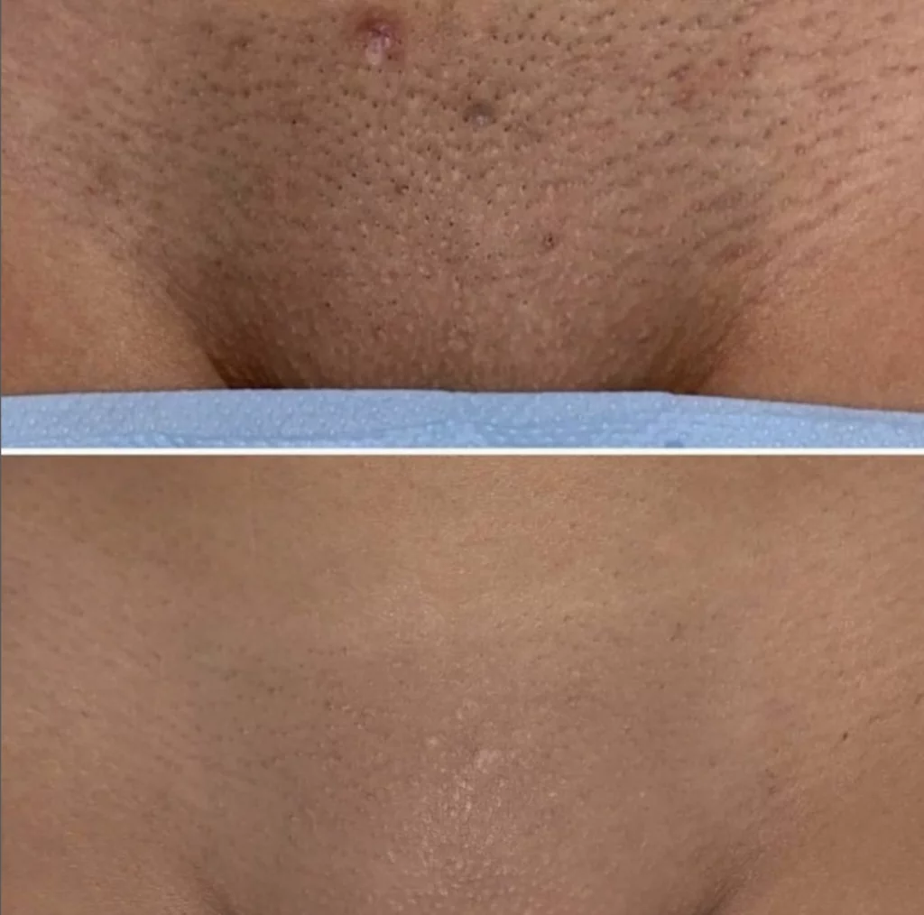 Screenshot-2023-10-30-at-18.08.56-1024x1014